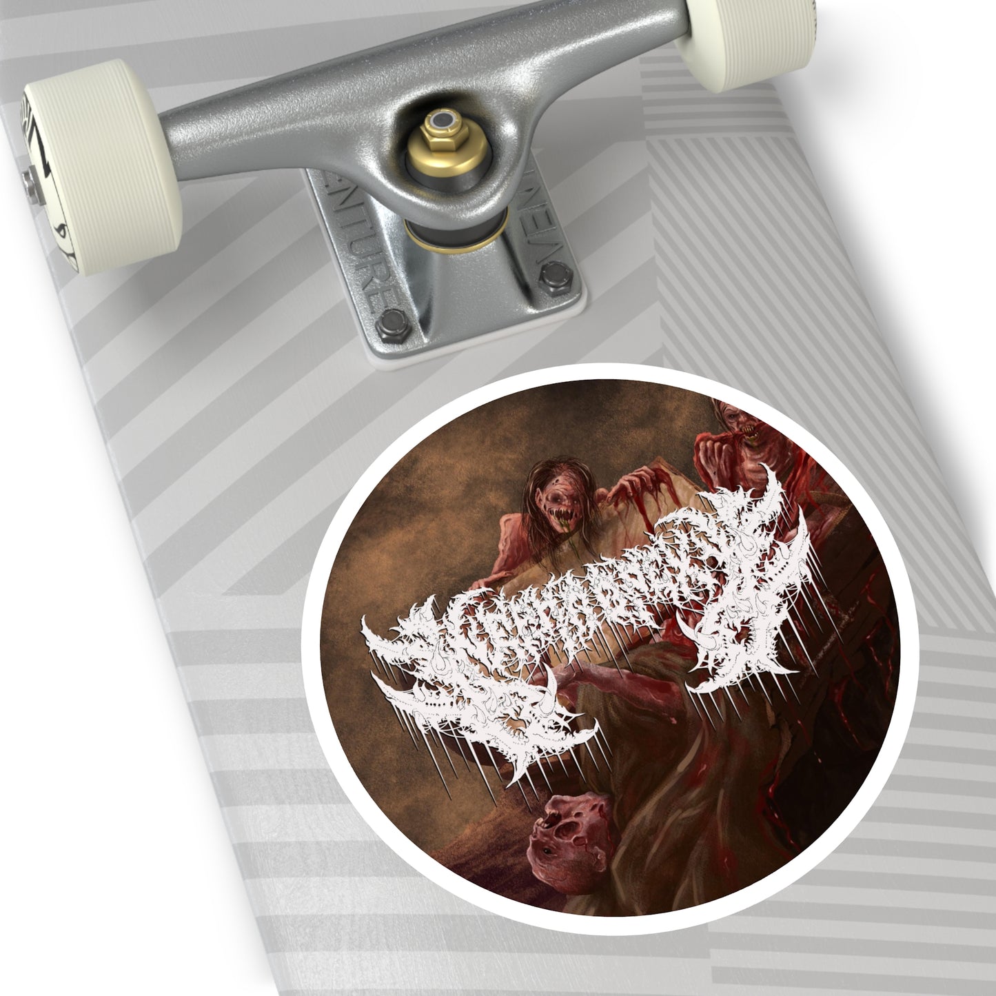 Nephropexy - Round Stickers, Indoor\Outdoor