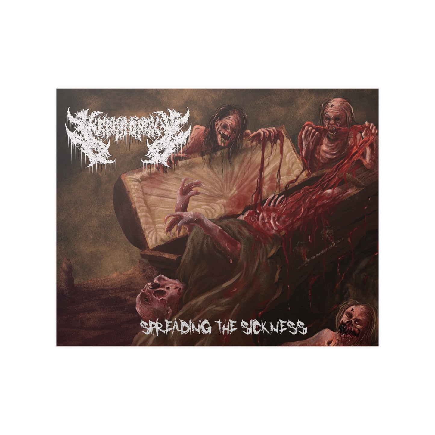 Nephropexy - Satin Poster