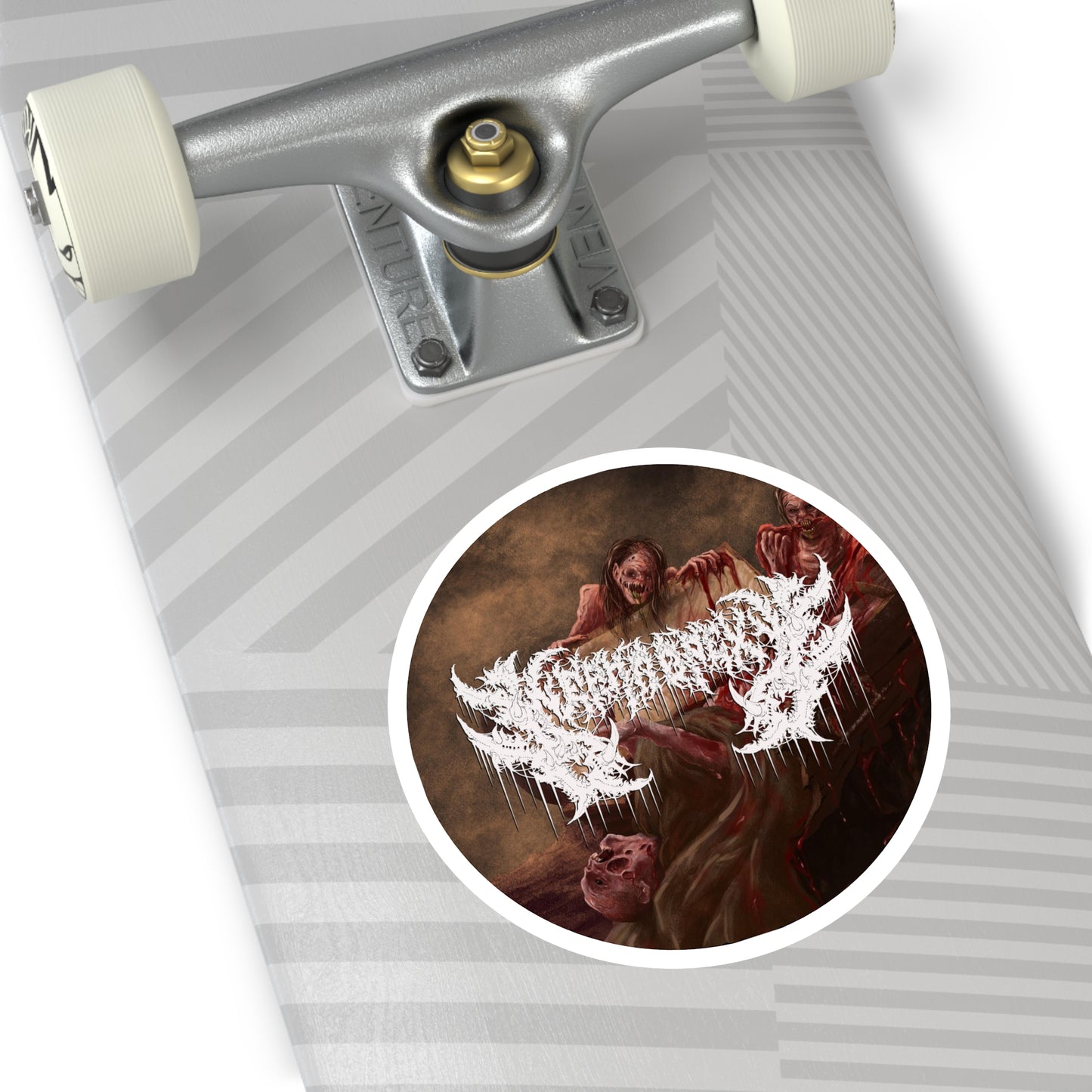 Nephropexy - Round Stickers, Indoor\Outdoor