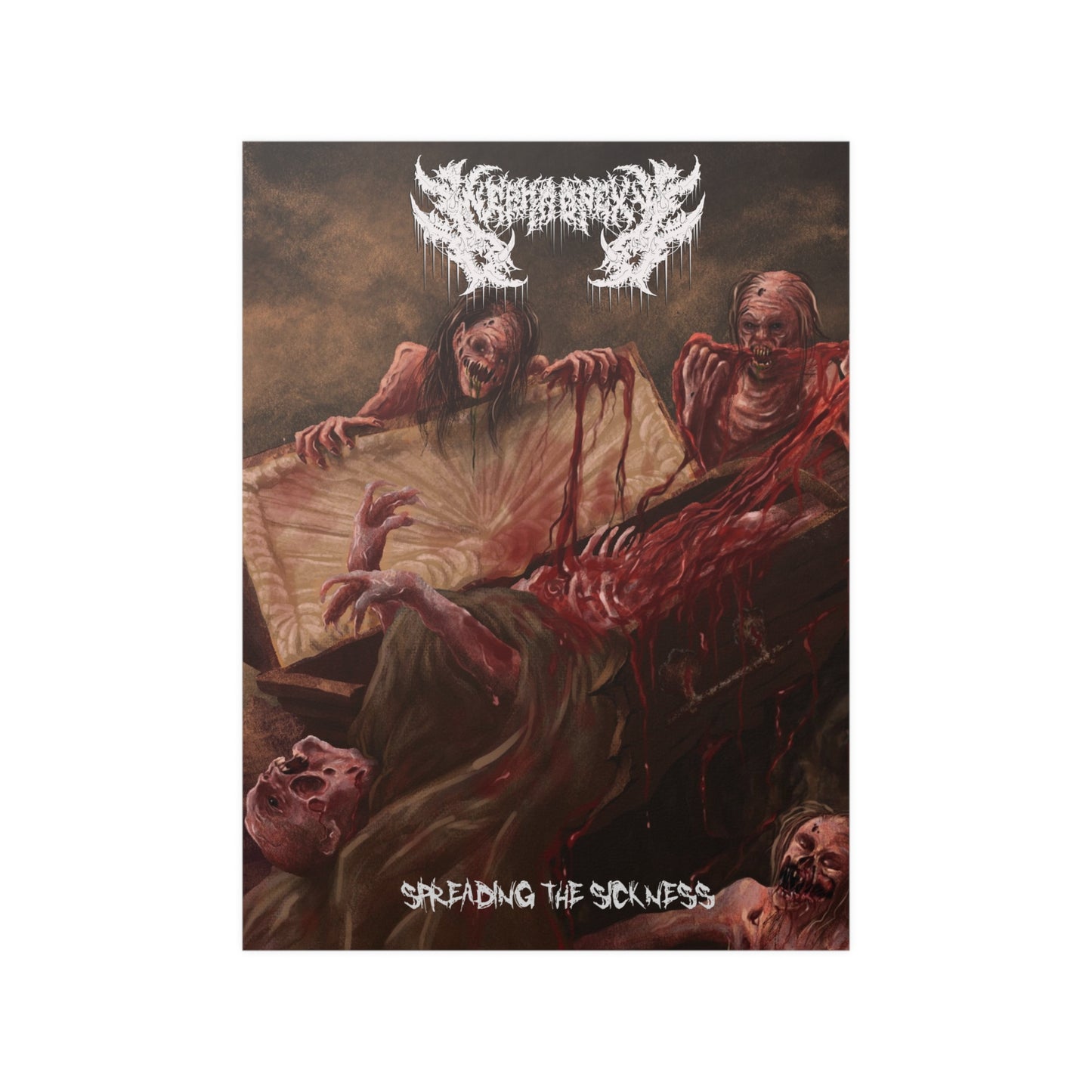 Nephropexy - Satin Poster
