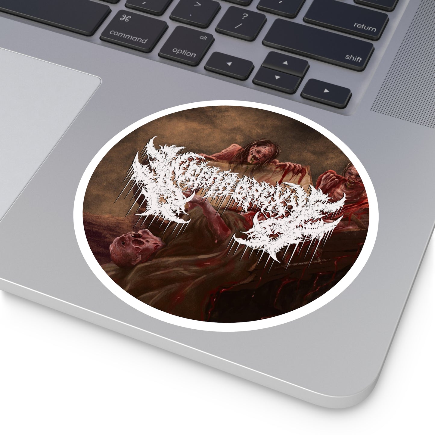 Nephropexy - Round Stickers, Indoor\Outdoor