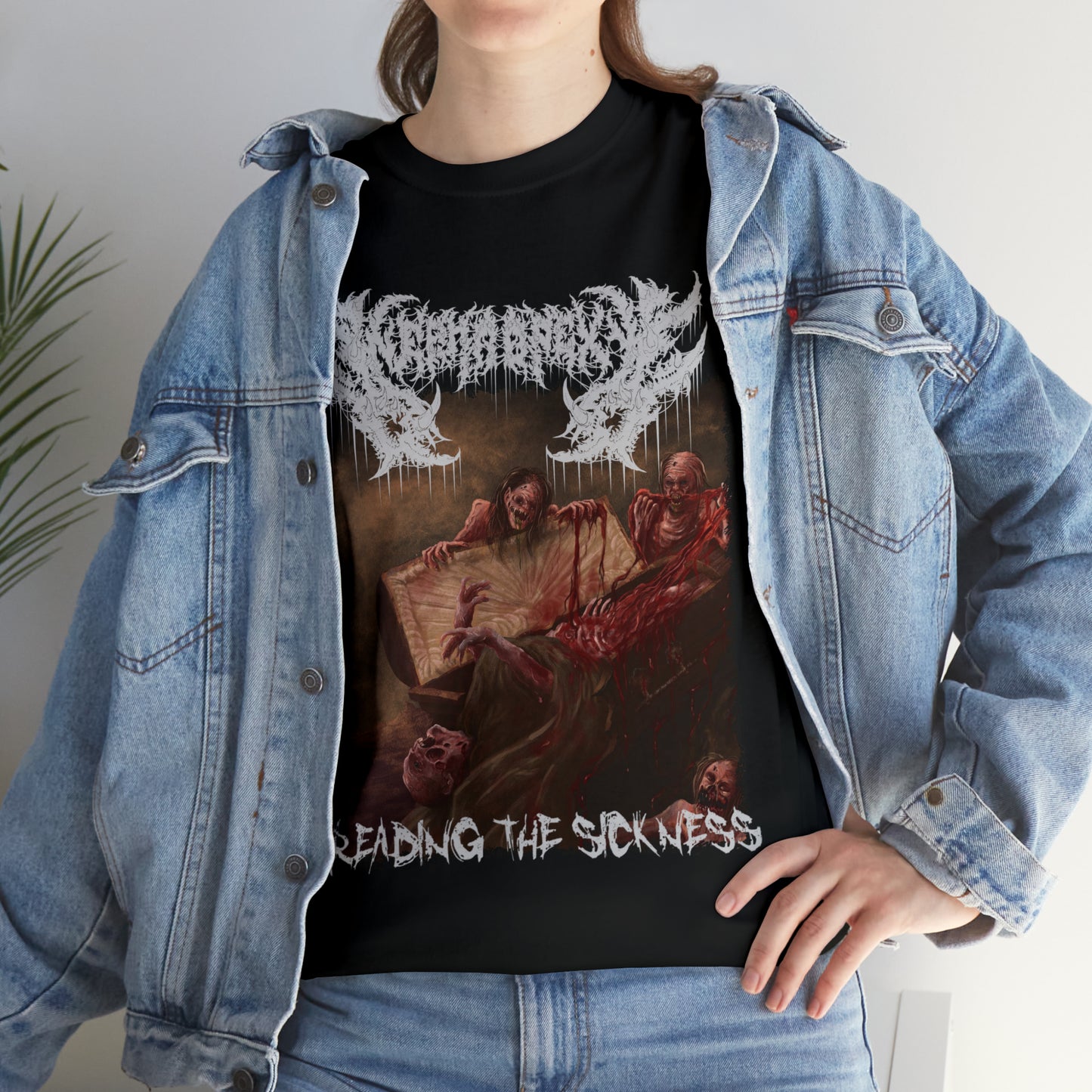 Nephropexy - Spreading the Sickness