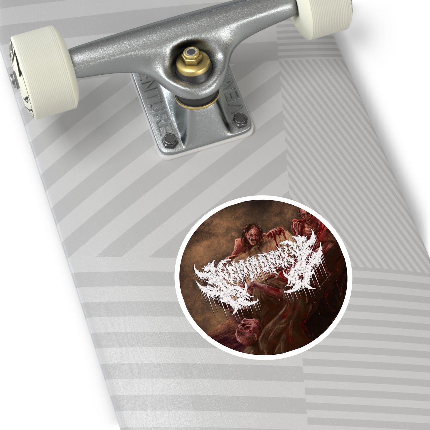 Nephropexy - Round Stickers, Indoor\Outdoor