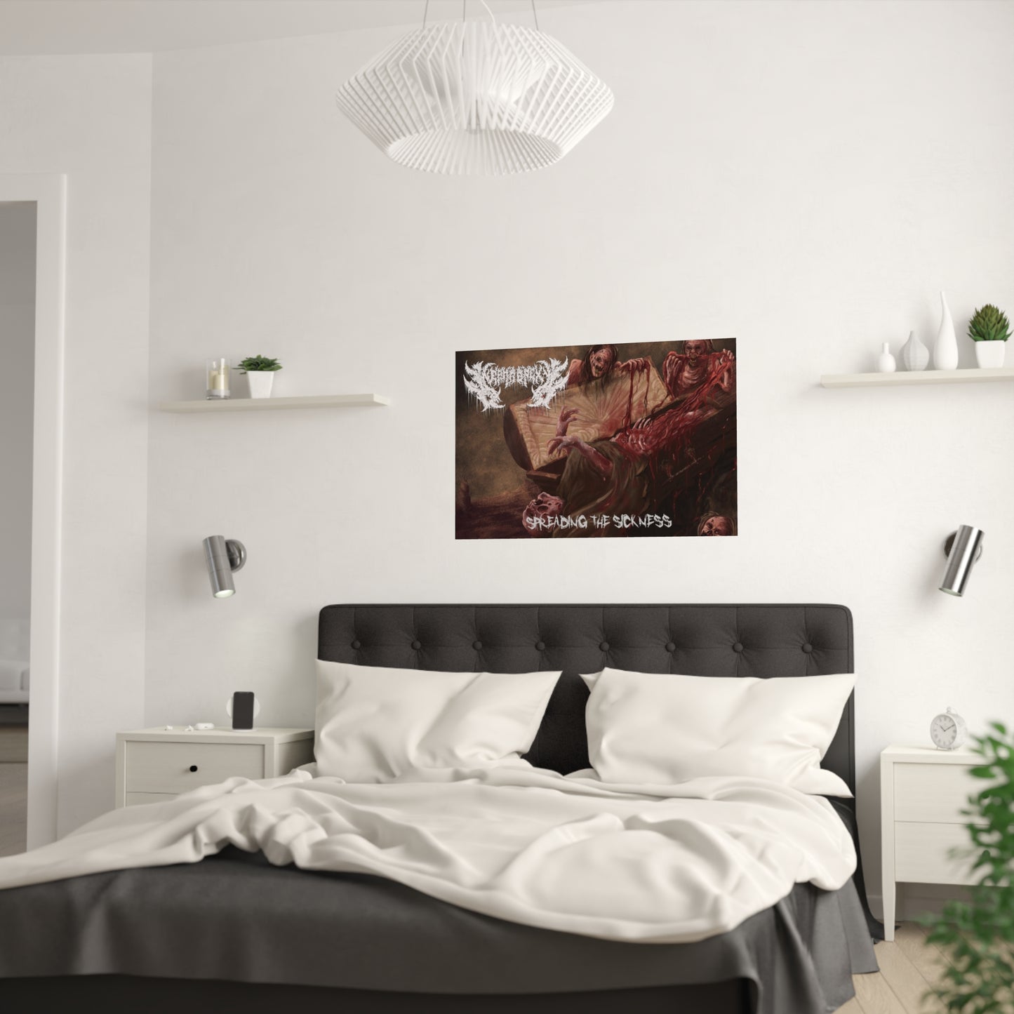Nephropexy - Satin Poster