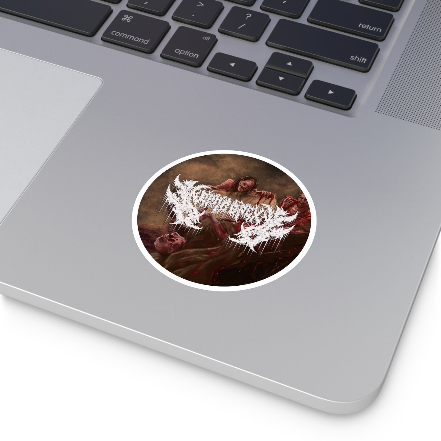 Nephropexy - Round Stickers, Indoor\Outdoor