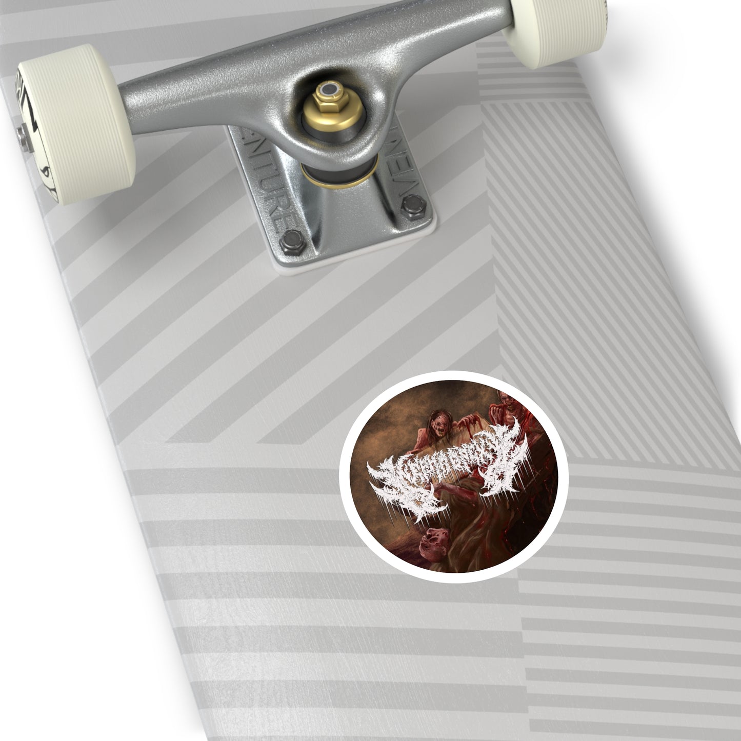 Nephropexy - Round Stickers, Indoor\Outdoor