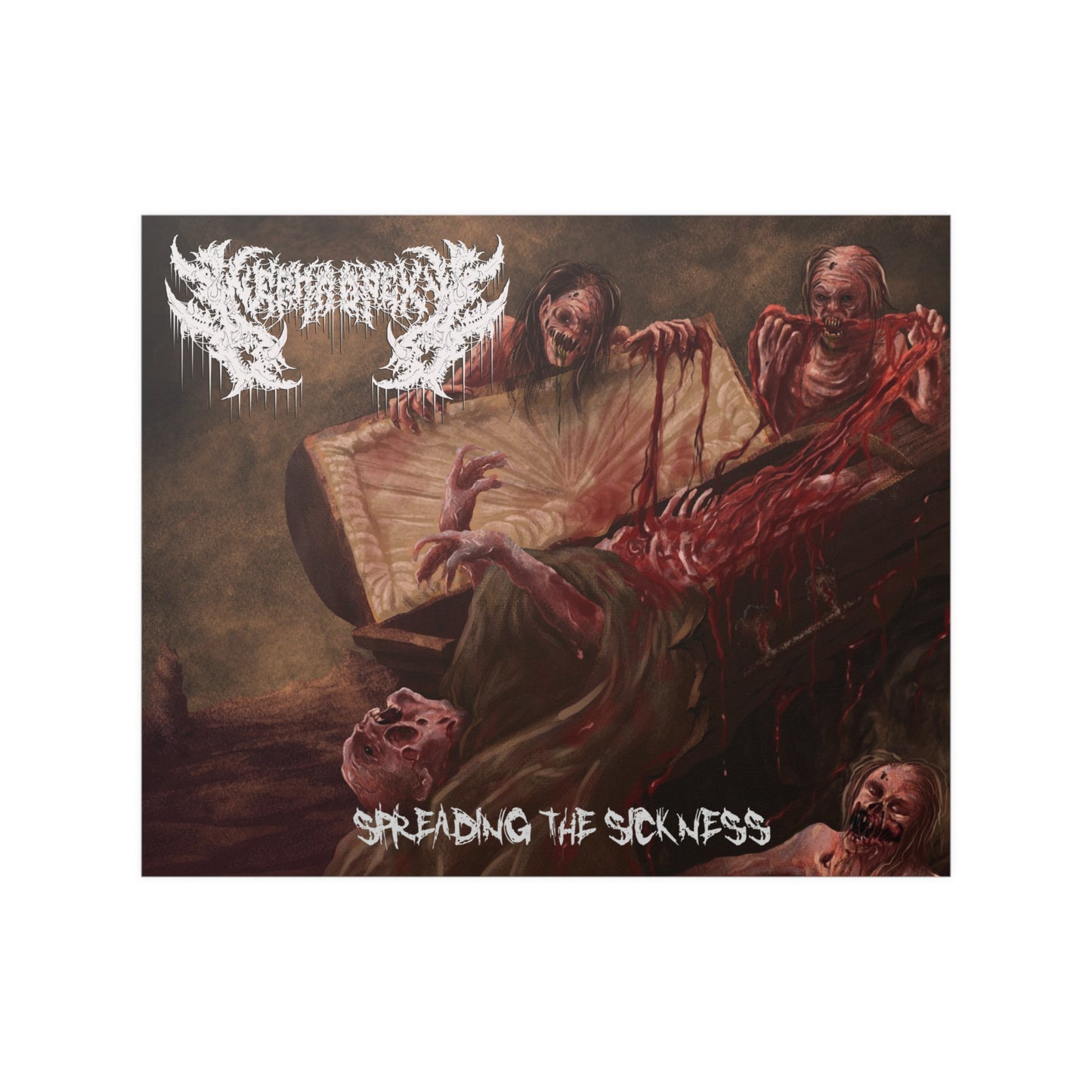 Nephropexy - Satin Poster