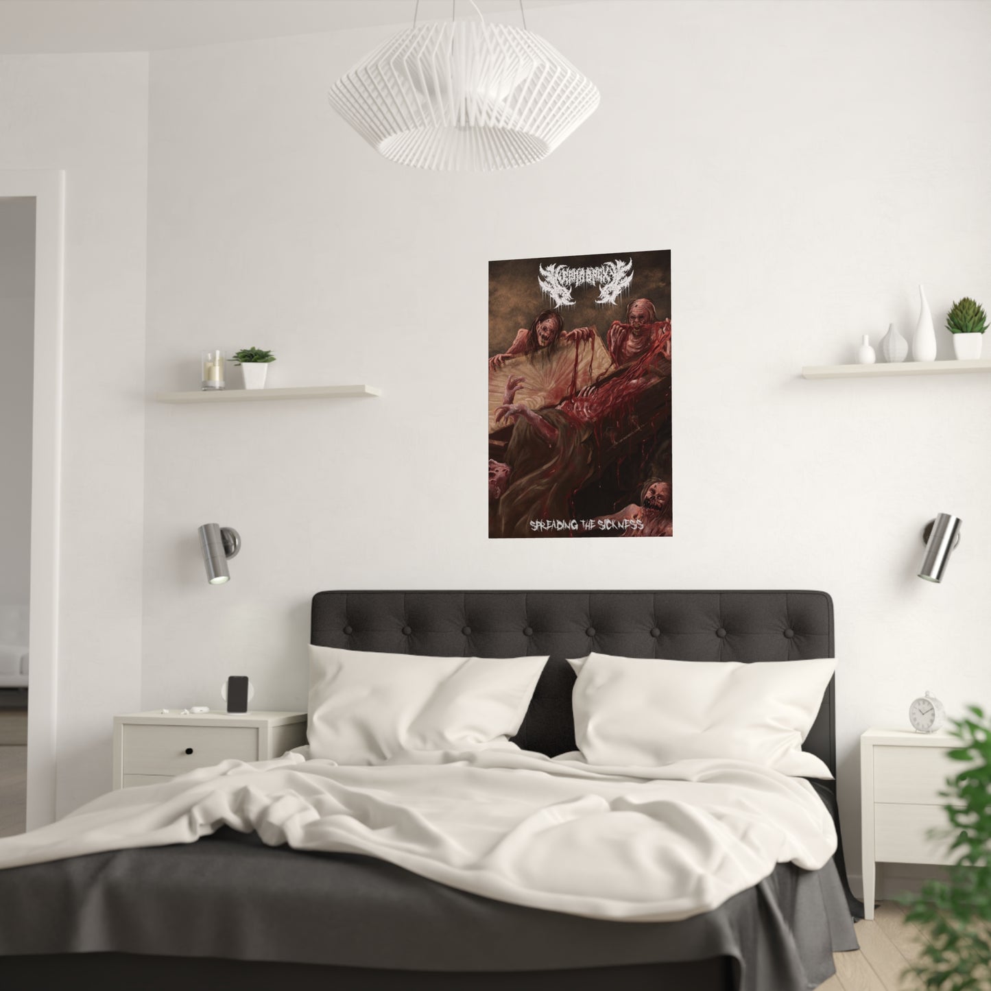 Nephropexy - Satin Poster