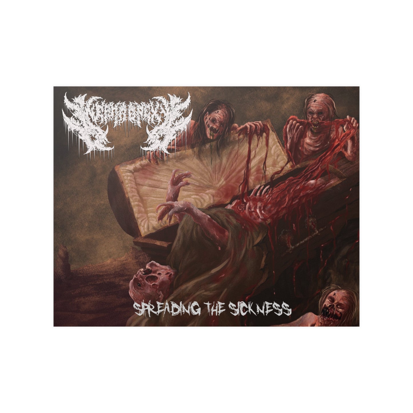 Nephropexy - Satin Poster
