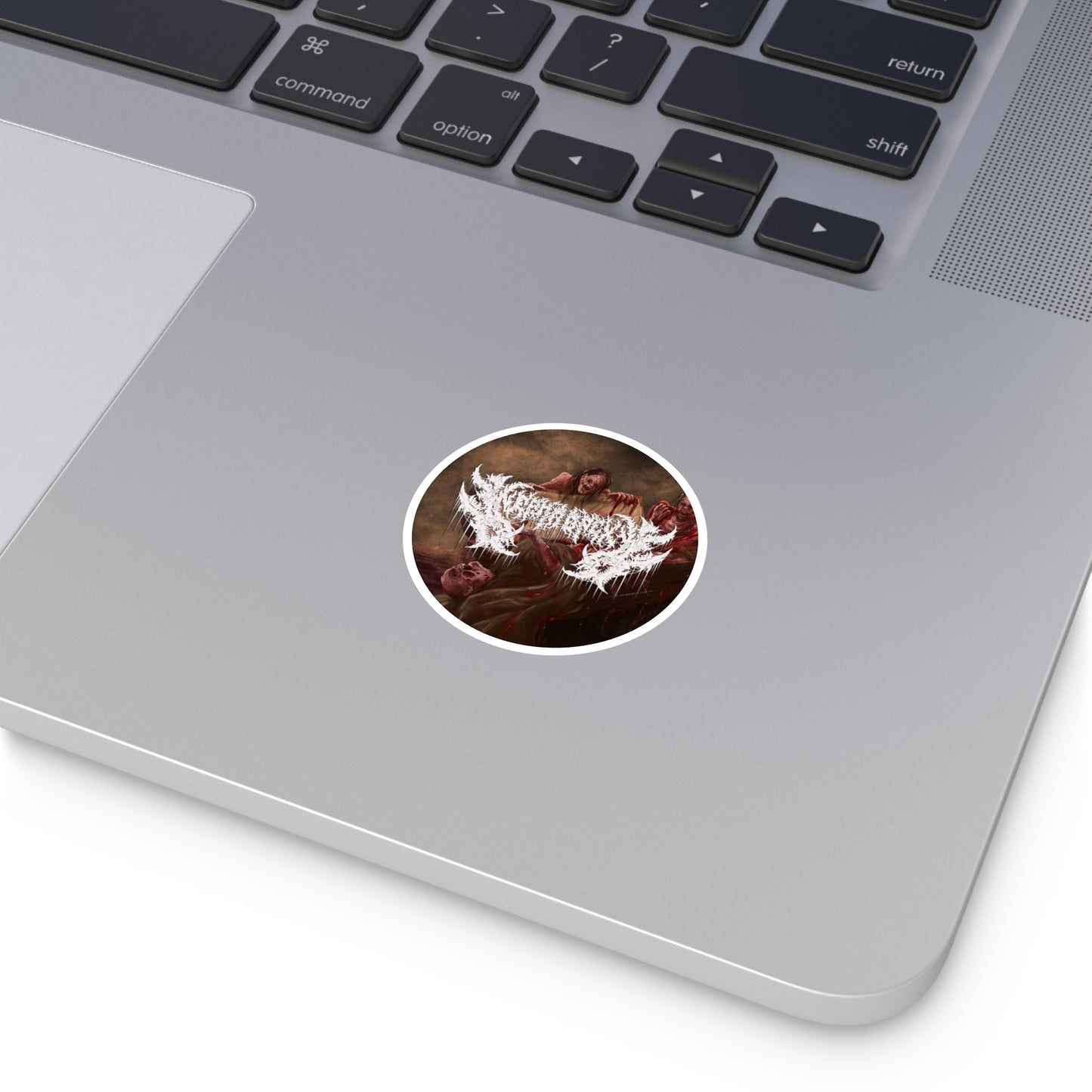 Nephropexy - Round Stickers, Indoor\Outdoor