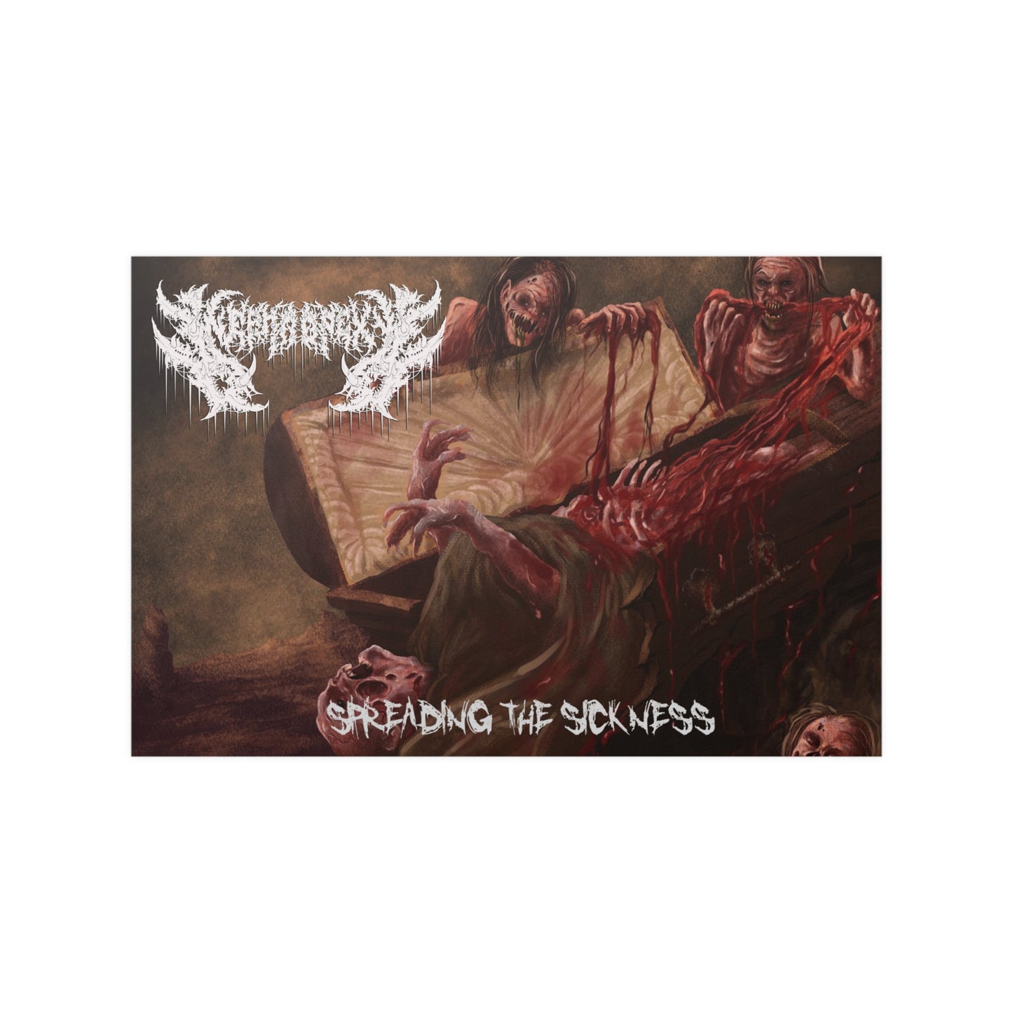 Nephropexy - Satin Poster