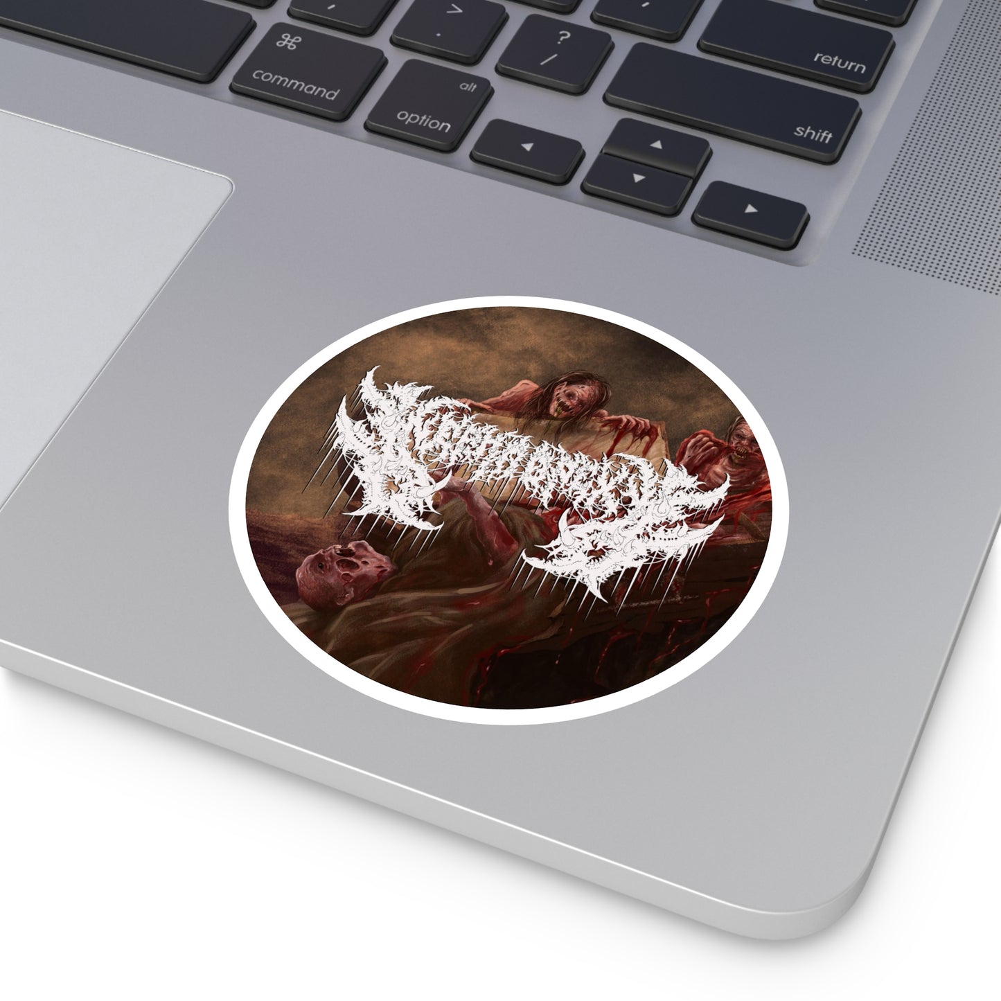 Nephropexy - Round Stickers, Indoor\Outdoor